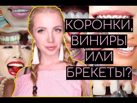 Видео: КОРОНКИ, ВИНИРЫ ИЛИ БРЕКЕТЫ?