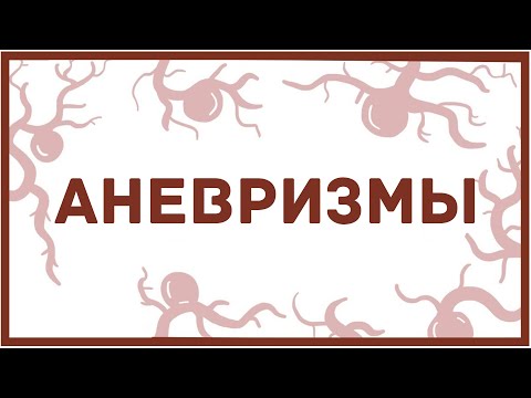 Видео: Аневризмы - виды, причины, симптомы, последствия