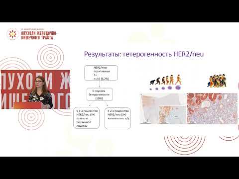 Видео: Оценка гетерогенности молекулярно-генетических маркеров при раке желудка