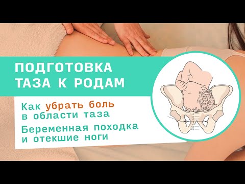 Видео: Симфизит при беременности. Симптомы - симфизит у беременных и подготовка к родам - 3 триместр без КС