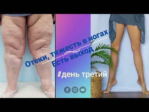 Видео: Снимаем отеки ,помогаем движению лимфы и крови.Ну,да придется постараться 
