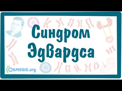 Видео: Синдром Эдвардса — [трисомия по 18-й хромосоме] — причины, симптомы, даигностика, лечение.