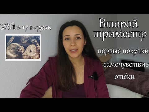 Видео: Второй триместр Часть 1/ УЗИ в 17 недель/ Самочувствие/ Одежда для беременных