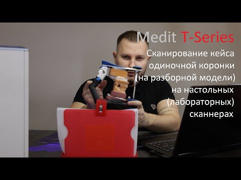 Видео: Сканирование кейса одиночной коронки на настольных(лабораторных) сканнерах / Medit T-Series