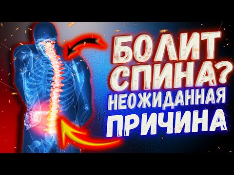 Видео: Болит спина? Неожиданная причина.