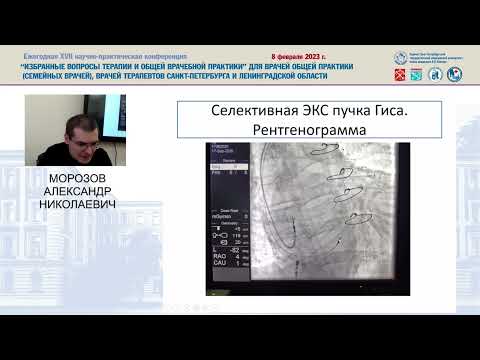 Видео: Особенности анализа ЭКГ у пациентов с имплантированными антиаритмическими устройствами