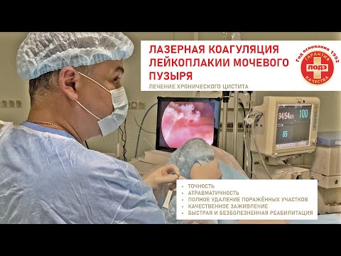 Видео: ЛЕЧЕНИЕ ХРОНИЧЕСКОГО ЦИСТИТА. ЛАЗЕРНАЯ КОАГУЛЯЦИЯ ЛЕЙКОПЛАКИИ МОЧЕВОГО ПУЗЫРЯ.