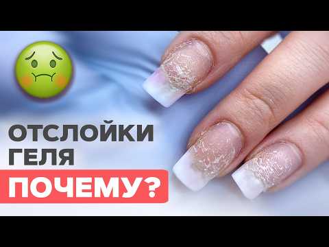 Видео: Неочевидные причины ОТСЛОЕК геля | Укрепление и стемпинг