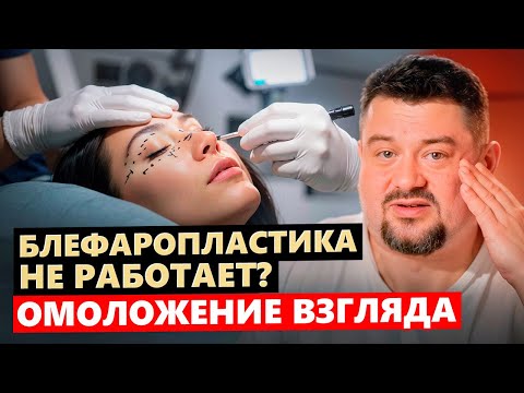 Видео: Омоложение взгляда и подтяжка век. Блефаропластика не работает?