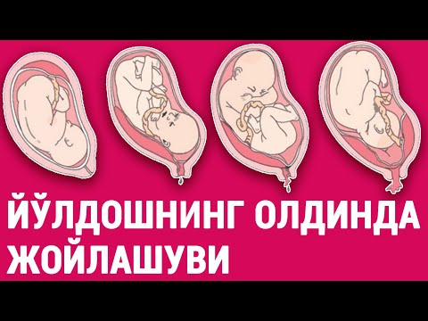 Видео: Йўлдошнинг олдинда жойлашуви