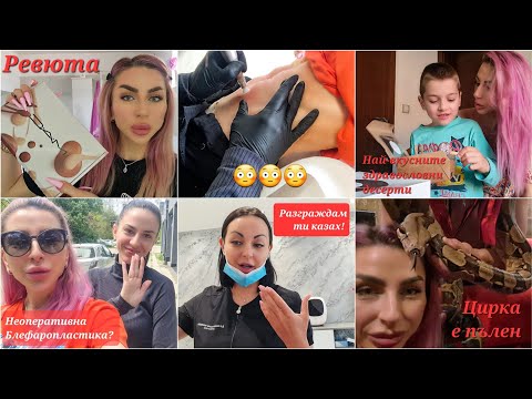Видео: Циркът е Пълен ▪ Неоперативна Блефаропластика ▪ Разградих си Устните Отново ▪ Много Ревюта