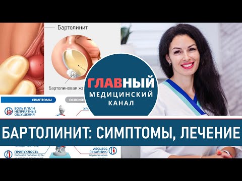 Видео: Бартолинит: симптомы, причины и лечение бартолинита. Воспаление бартолиновой железы