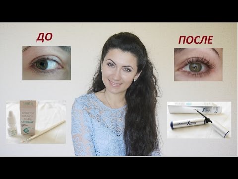 Видео: Длинные ресницы КАК? Xlash vs Careprost
