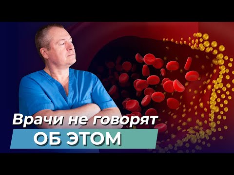 Видео: Холестерин правда и мифы. Как СНИЗИТЬ холестерин БЕЗ лекарств? Польза холестерина! Атеросклероз