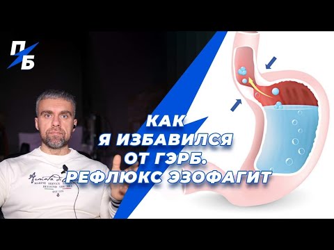 Видео: Как я избавился от ГЭРБ. Рефлюкс эзофагит