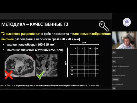 Видео: Сложности МРТ диагностики опухолей таза.  Продвинутый уровень.