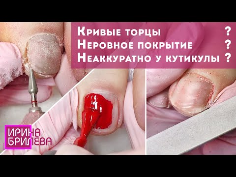 Видео: Педикюр 🌸 Кривые торцы 🌸 Неровное покрытие 🌸 Неаккуратно у кутикулы 🌸Педикюр пальчики