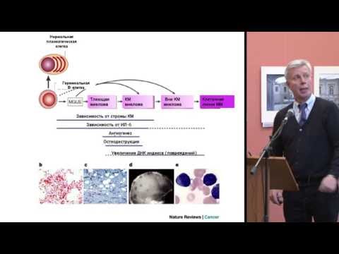Видео: В.В. Птушкин, Новые препараты в лечении множественной миеломы.