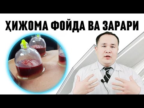 Видео: ХИДЖОМА ХАҚИДА ХАҚИҚАТЛАР ВА БОР ГАПНИ АЙТИБ БЕРАМАН