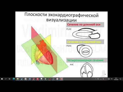 Видео: ЭхоКГ  Аккредсценарии 2 и 3  Часть 1  12022 04 12 14 07 36