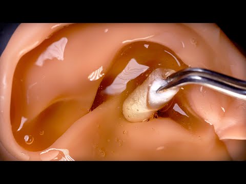 Видео: [АСМР] Снимите мембрану с ушей 👂️ Лучший пусковой механизм для сна с небес 👼🌙💤