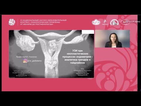 Видео: УЗИ при неопластических процессах эндометрия. Проф. Гажонова. В.Е.