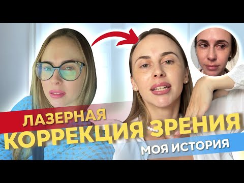 Видео: Лазерная коррекция зрения | femto lasik , smile | как прошла лазерная коррекция зрения | довольна ли