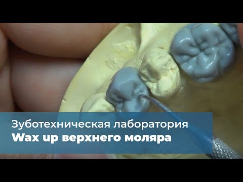 Видео: Wax up верхнего моляра
