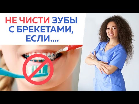 Видео: Вот как надо ухаживать за зубами в брекетах! / Как чистить зубы в брекетах?