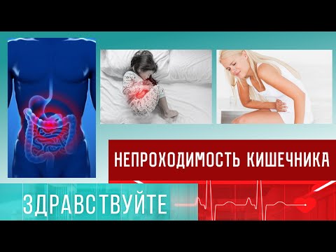 Видео: Непроходимость кишечника. Программа "Здравствуйте" - 09/04/23