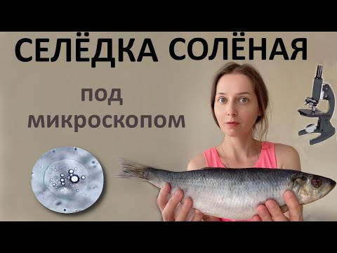 Видео: Селёдка под микроскопом. Кровь после поедания селедки кишит микроорганизмами.