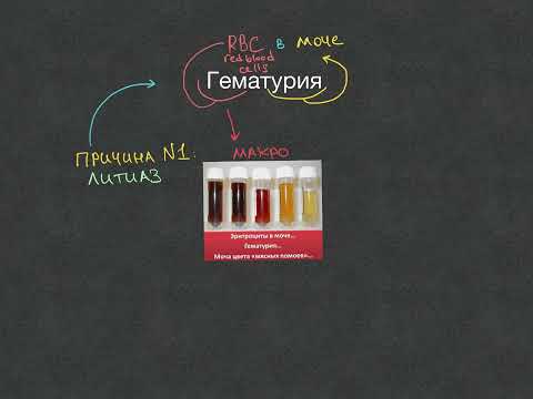 Видео: Нефрология - Гематурия - Урок 8