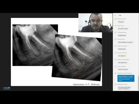 Видео: Endo.Education Вебинар Андрея Афанютина Микробиологические основы дезинфекции корневых каналов