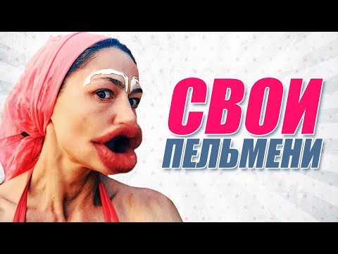 Видео: ЗВЕЗДЫ ДО и ПОСЛЕ ПЛАСТИКИ ГУБ