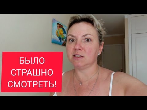 Видео: ОПАСНЫЙ МЕТОД! ЭТО ВСЁ ЛЕЧИТСЯ! 🥰👍 Тенерифе. Испания