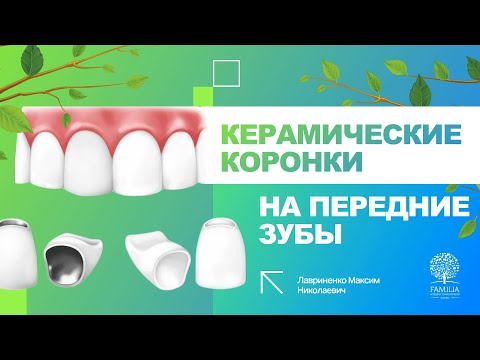 Видео: 😁 Керамические коронки на передние зубы