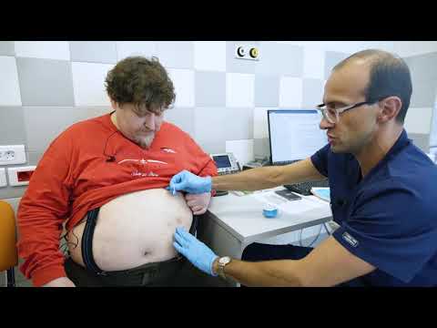 Видео: Установка инъекционного порта для введения инсулина в Ильинской больнице