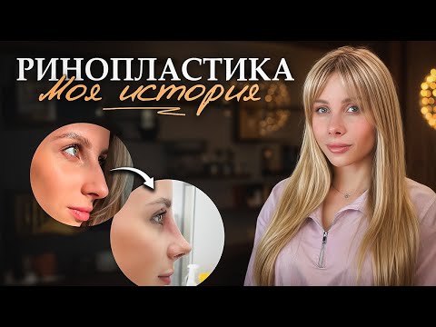 Видео: Я мечтала стать красивее, но ринопластика пошла не по плану...