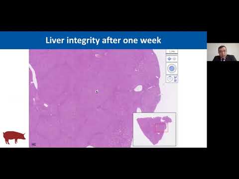 Видео: A1. Опыт недельной перфузии печени
