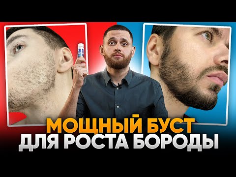 Видео: В 32 года плохо росла борода. Результаты ксиноксина для роста бороды за 7 месяцев