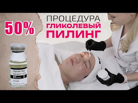 Видео: Процедура Гликолевый пилинг 50%