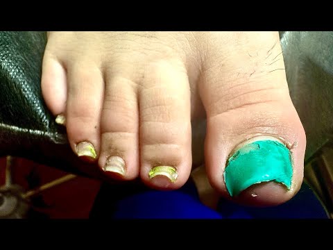 Видео: Невероятное преображение 😱😱😱треш педикюр