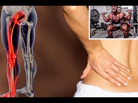 Видео: Боли в СПИНЕ после Тяги или Приседа - РЕЦИДИВ