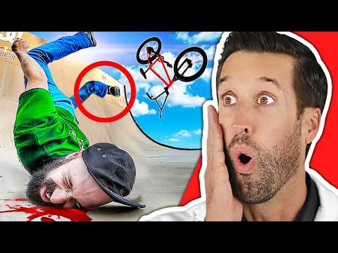 Видео: ВРАЧ смотрит на самые БОЛЕЗНЕННЫЕ неудачи на BMX велосипеде