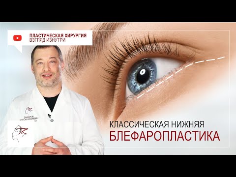 Видео: Нижняя блефаропластика