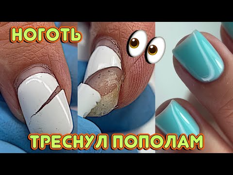 Видео: Ноготь треснул пополам 😟 100% способ избежать отслоек / Лайфхак для маникюра