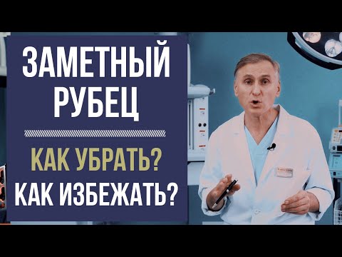 Видео: РУБЕЦ 😱 КАК УБРАТЬ ШРАМЫ, КАК ПРЕДОТВРАТИТЬ❓