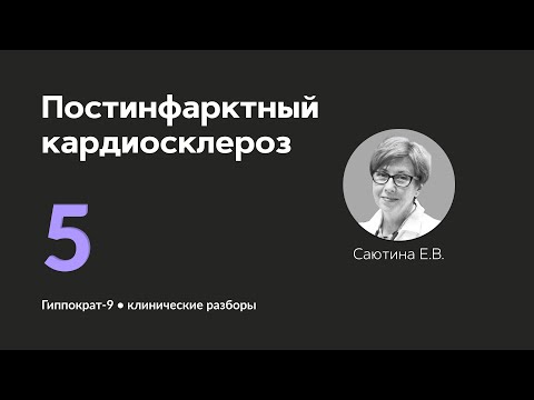 Видео: Постинфарктный кардиосклероз. 10.09.24.