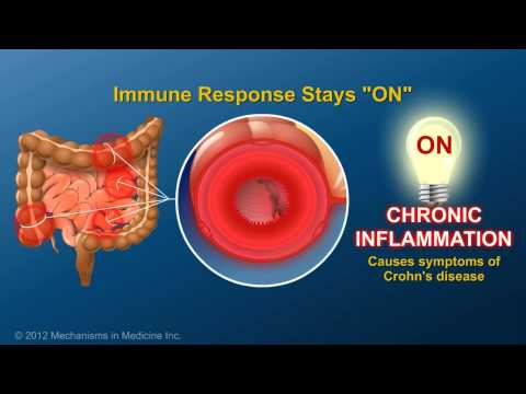 Видео: 3_ Болезнь Крона  Анимация
