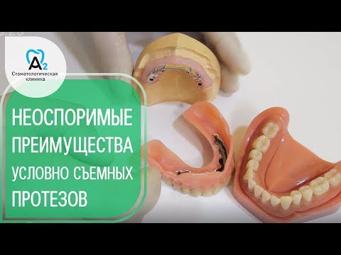 Видео: Протезы на имплантах. 😀 Почему стоит выбрать  условно съемные протезы на имплантах. 12+